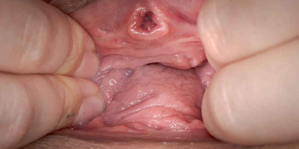 Five Weeks After Birth - intro photo