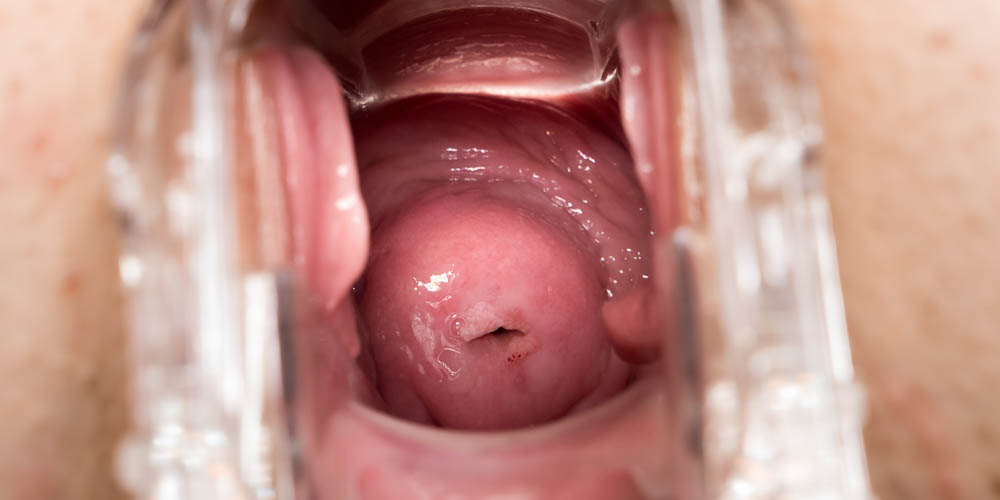 Speculum In Motion - intro photo