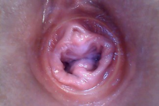 click to see the video/photos: 'RAW endoscopic video'